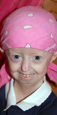 Hayley Okines, British progeria campaigner, dies at age 17